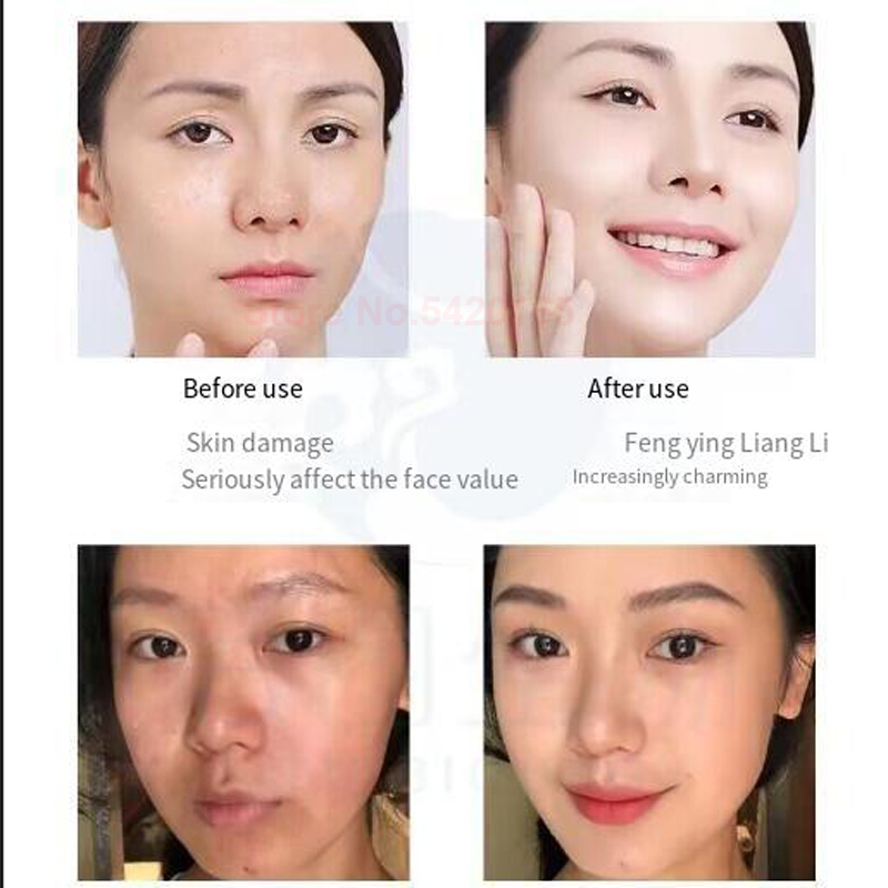 Сыворотка с лиофилизированным  – обзор и цена Epidermal Growth Factor