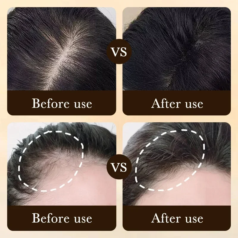 Биотиновое масло для быстрого  – обзор и цена Epidermal Growth Factor