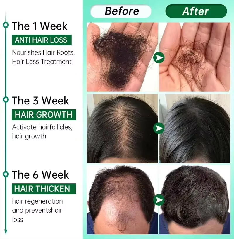 Сыворотка для роста волос: Быс – обзор и цена Epidermal Growth Factor